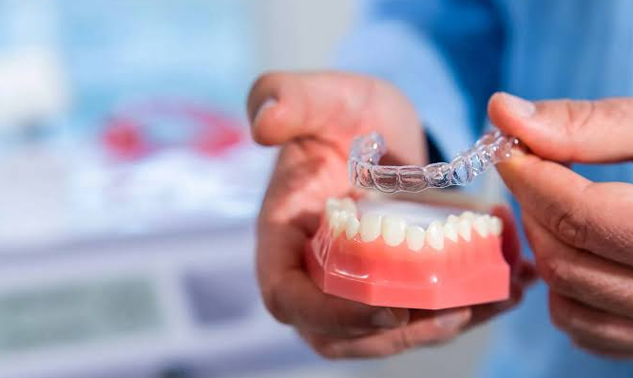 Aligner (Invisalign Provider)