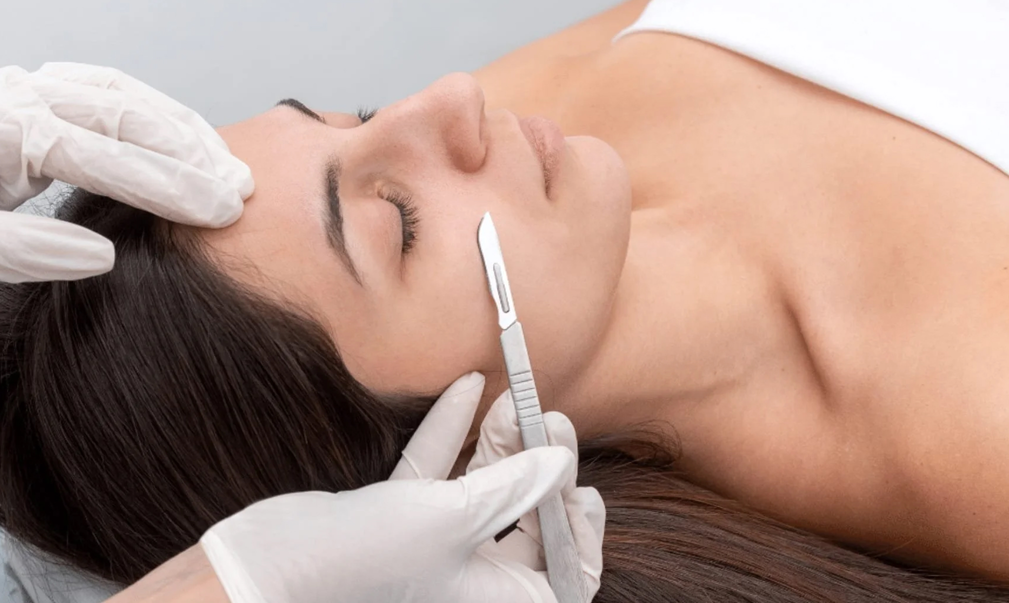 Dermaplaning